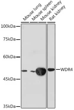 Invitrogen WDR4 Recombinant Rabbit Monoclonal Antibody (5R7B6) 100 &mu;L | Buy Online | Invitrogen&trade; | Fisher Scientific
