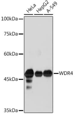 Invitrogen WDR4 Recombinant Rabbit Monoclonal Antibody (5R7B6) 100 &mu;L | Buy Online | Invitrogen&trade; | Fisher Scientific