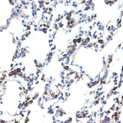 Invitrogen ERP29 Recombinant Rabbit Monoclonal Antibody (1J0D3) 100 &mu;L;