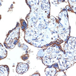 Invitrogen ERP29 Recombinant Rabbit Monoclonal Antibody (1J0D3) 100 &mu;L;