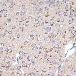 Invitrogen ERP29 Recombinant Rabbit Monoclonal Antibody (1J0D3) 100 &mu;L;