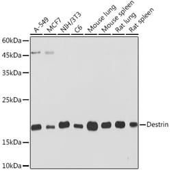 Invitrogen Destrin Recombinant Rabbit Monoclonal Antibody (4F9Q1) 100 &mu;L:Antibodies,