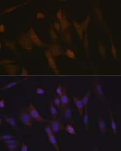 Invitrogen TNPO3 Recombinant Rabbit Monoclonal Antibody (0U3Q1) 100 &mu;L;