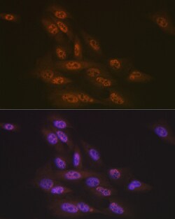 Invitrogen TNPO3 Recombinant Rabbit Monoclonal Antibody (0U3Q1) 100 &mu;L;