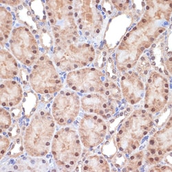 Invitrogen TNPO3 Recombinant Rabbit Monoclonal Antibody (0U3Q1) 100 &mu;L;