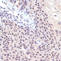Invitrogen TNPO3 Recombinant Rabbit Monoclonal Antibody (0U3Q1) 100 &mu;L;
