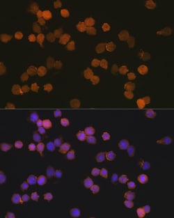 Invitrogen™ IBA1 Recombinant Rabbit Monoclonal Antibody (6X3D0)