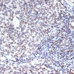 Invitrogen UNC84B Recombinant Rabbit Monoclonal Antibody (8E8D7) 100 &mu;L;