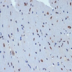 Invitrogen UNC84B Recombinant Rabbit Monoclonal Antibody (8E8D7) 100 &mu;L;