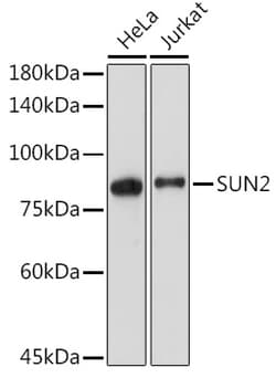 Invitrogen UNC84B Recombinant Rabbit Monoclonal Antibody (8E8D7) 100 &mu;L;