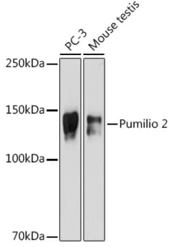 PUM2 Recombinant Rabbit Monoclonal Antibody (7M1B1) 100 &mu;L:Antibodies,