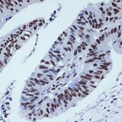 Invitrogen Pokemon Recombinant Rabbit Monoclonal Antibody (3T2J1) 100 &mu;L;