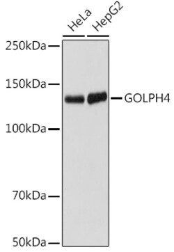 Invitrogen GOLIM4 Recombinant Rabbit Monoclonal Antibody (10J7E6) 100 &mu;L;