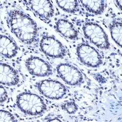 Invitrogen Cdc40 Recombinant Rabbit Monoclonal Antibody (2I8I7) 100 &mu;L;