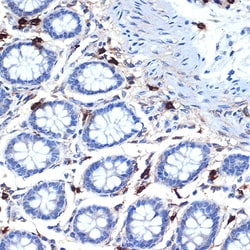 Invitrogen Tryptase Recombinant Rabbit Monoclonal Antibody (6U1C5) 100