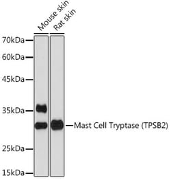 Invitrogen Tryptase Recombinant Rabbit Monoclonal Antibody (6U1C5) 100