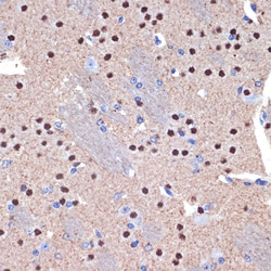 Invitrogen BCL11B Recombinant Rabbit Monoclonal Antibody (9C1B6) 100 &mu;L;