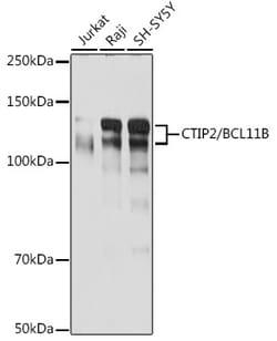 Invitrogen BCL11B Recombinant Rabbit Monoclonal Antibody (9C1B6) 100 &mu;L;