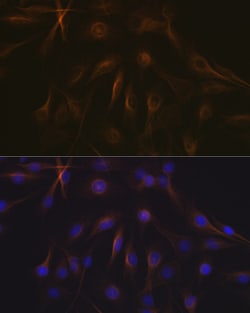 Invitrogen TUBB1 Recombinant Rabbit Monoclonal Antibody (2Z6P1) 100 &mu;L;