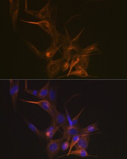 Invitrogen TUBB1 Recombinant Rabbit Monoclonal Antibody (2Z6P1) 100 &mu;L;