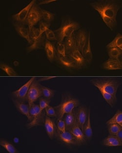 Invitrogen TUBB1 Recombinant Rabbit Monoclonal Antibody (2Z6P1) 100 &mu;L;