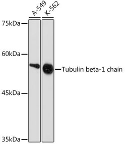 Invitrogen TUBB1 Recombinant Rabbit Monoclonal Antibody (2Z6P1) 100 &mu;L;