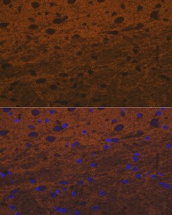 Invitrogen Syntaxin 1 Recombinant Rabbit Monoclonal Antibody (7D9V8) 100 &mu;L | Buy Online | Invitrogen&trade; | Fisher Scientific