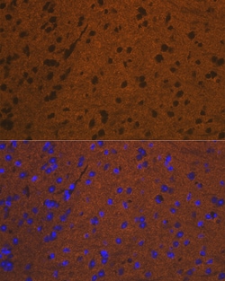 Invitrogen Syntaxin 1 Recombinant Rabbit Monoclonal Antibody (7D9V8) 100 &mu;L | Buy Online | Invitrogen&trade; | Fisher Scientific