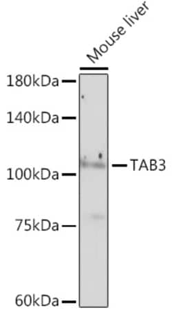 Invitrogen TAB3 Recombinant Rabbit Monoclonal Antibody (3Y6T7) 100 &mu;L;