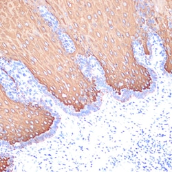 Invitrogen Cytokeratin 6 Recombinant Rabbit Monoclonal Antibody (3F7A1)
