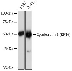 Invitrogen Cytokeratin 6 Recombinant Rabbit Monoclonal Antibody (3F7A1)