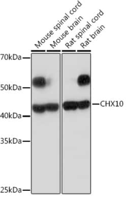 Invitrogen CHX10 Recombinant Rabbit Monoclonal Antibody (4Z4R2) 100 &mu;L;