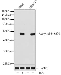 Invitrogen Acetyl-p53 (Lys370) Recombinant Rabbit Monoclonal Antibody (9X9X3)