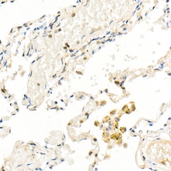Invitrogen FADD Recombinant Rabbit Monoclonal Antibody (10L6M0) 100 &mu;L;