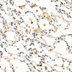 Invitrogen FADD Recombinant Rabbit Monoclonal Antibody (10L6M0) 100 &mu;L;