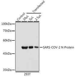 Invitrogen SARS-CoV-2 Nucleocapsid Monoclonal Antibody (7P1G6) 100 &mu;L | Buy Online | Invitrogen&trade; | Fisher Scientific