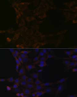 Invitrogen HSPA14 Recombinant Rabbit Monoclonal Antibody (4L1Z6) 100 &mu;L;