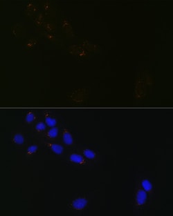 Invitrogen GRASP65 Recombinant Rabbit Monoclonal Antibody (3F2I1) 100 &mu;L;