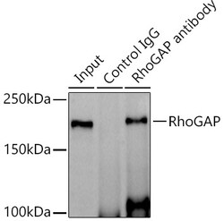 Invitrogen ARHGAP5 Recombinant Rabbit Monoclonal Antibody (3L9I3) 100 &mu;L | Buy Online | Invitrogen&trade; | Fisher Scientific