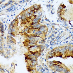 Invitrogen Lefty1/Lefty2 Recombinant Rabbit Monoclonal Antibody (2Y10P2)