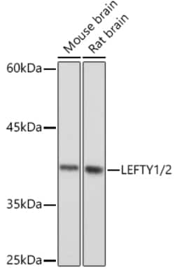 Invitrogen Lefty1/Lefty2 Recombinant Rabbit Monoclonal Antibody (2Y10P2)
