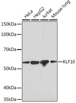 Invitrogen KLF10 Recombinant Rabbit Monoclonal Antibody (2Y1Q6) 100 &mu;L | Buy Online | Invitrogen&trade; | Fisher Scientific