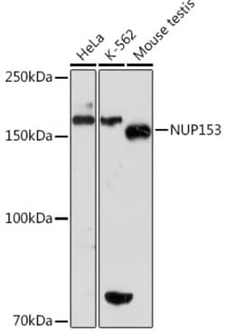 Invitrogen NUP153 Recombinant Rabbit Monoclonal Antibody (3I5V3) 100 &mu;L | Buy Online | Invitrogen&trade; | Fisher Scientific