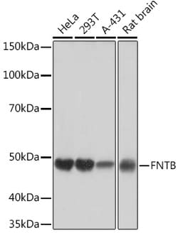 Invitrogen FNTB Recombinant Rabbit Monoclonal Antibody (3I4X5) 100 &mu;L | Buy Online | Invitrogen&trade; | Fisher Scientific