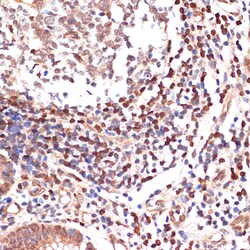 Invitrogen ALOX5 Recombinant Rabbit Monoclonal Antibody (5C5Z2) 100 &mu;L;