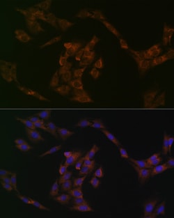 Invitrogen IRF6 Recombinant Rabbit Monoclonal Antibody (5D1Z4) 100 &mu;L;