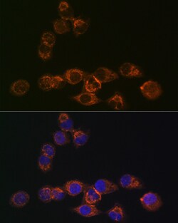 Invitrogen IRF6 Recombinant Rabbit Monoclonal Antibody (5D1Z4) 100 &mu;L;