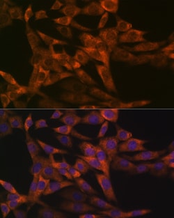 Invitrogen IRF6 Recombinant Rabbit Monoclonal Antibody (5D1Z4) 100 &mu;L;