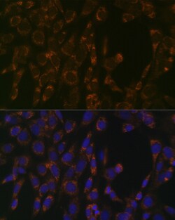 CLPP Recombinant Rabbit Monoclonal Antibody (ARC1929), Invitrogen 100 &mu;L;
