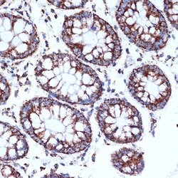 CLPP Recombinant Rabbit Monoclonal Antibody (ARC1929), Invitrogen 100 &mu;L;